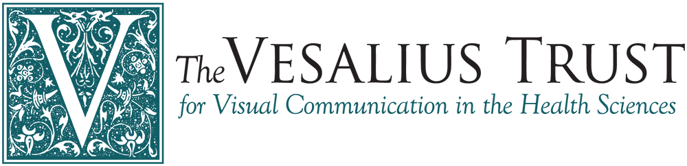 Vesalius Trust